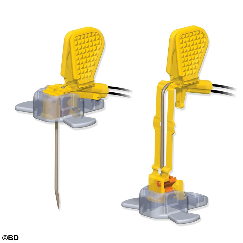 MiniLoc Sicherheitsinfusionsset ohne Y-Adapter 19 G x 25 mm (20 Stck.)