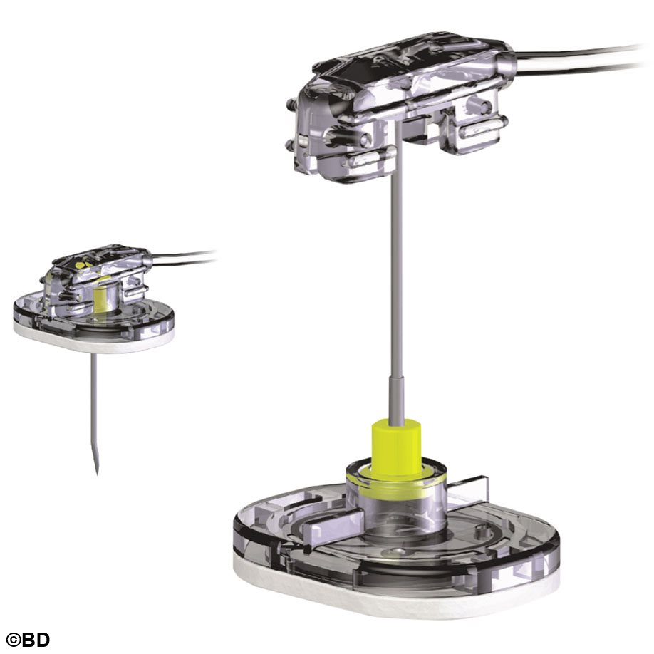 SafeStep Huber Nadelset zur Portpunktion ohne Y-Adapter, 19 G 19 mm (25 Stck.)