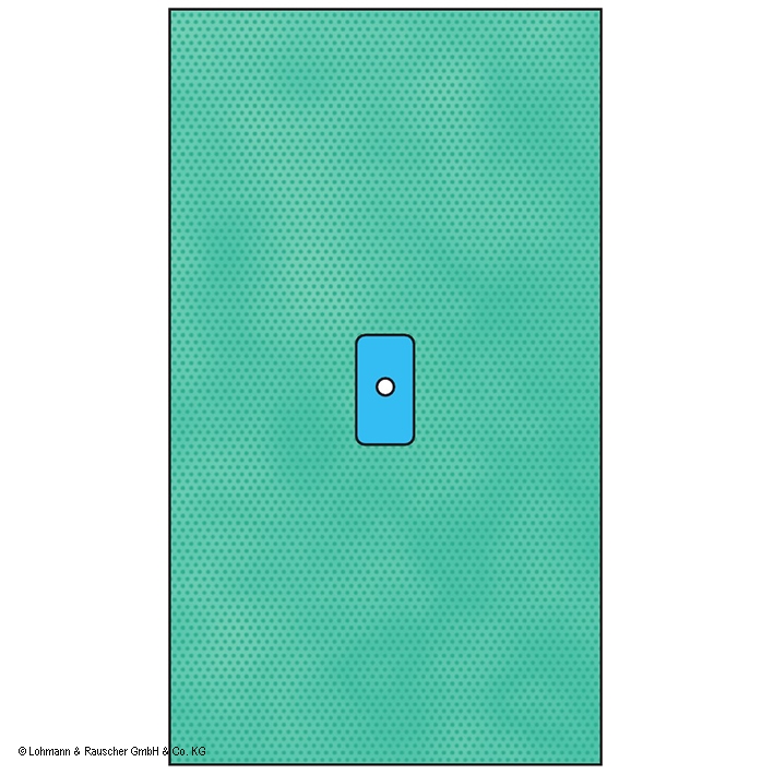 Raucodrape PRO Extremitätentücher Hand/Fuß steril, 225 x 300 cm (10 Stck.)