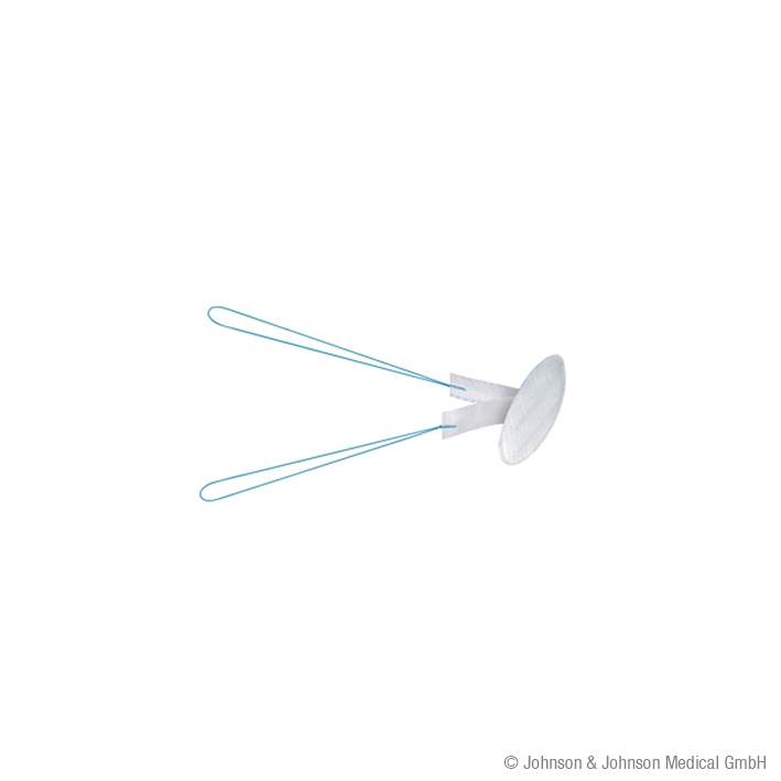 Proceed Ventral Patch Ø 4,3 cm PROLENE-PDS-ORZ (2 Stck.)
