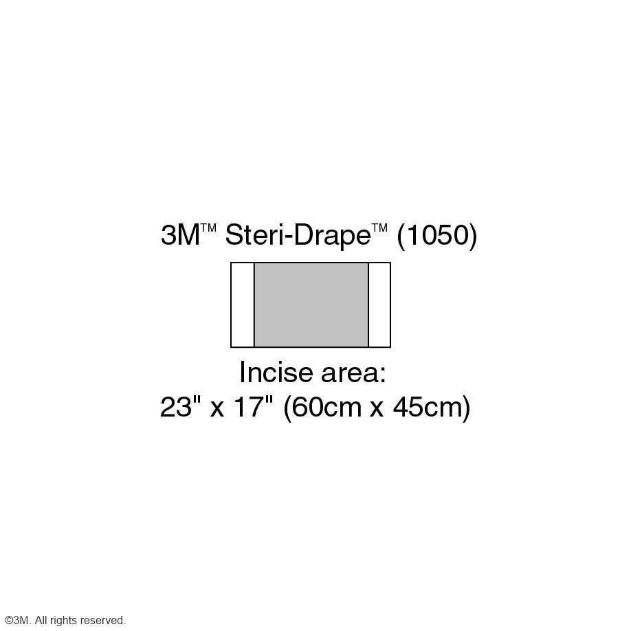 3M Steri-Drape 1 Inzisionsfolien 45 x 82 cm (10 Stck.)