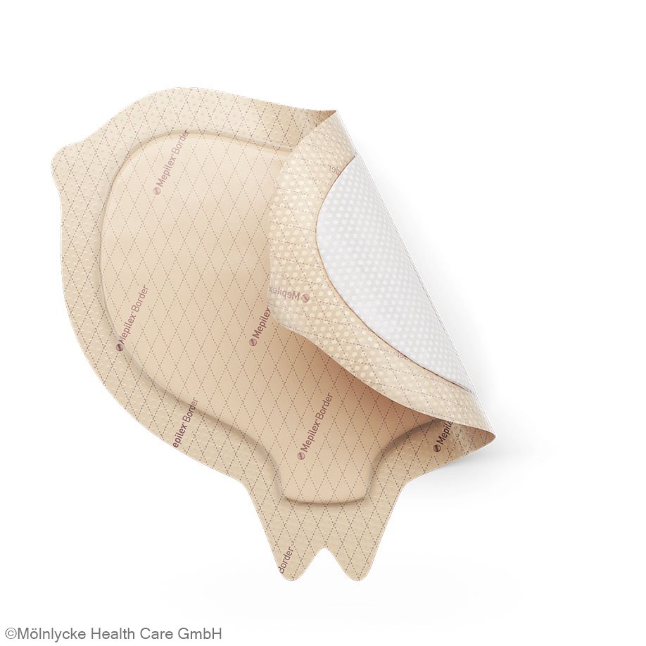 Mepilex Border Sacrum Schaumverband steril, 16 x 20 cm (5 Stck.)