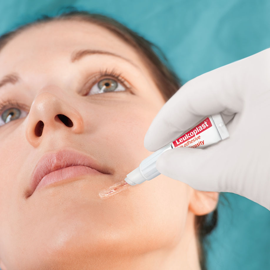 Leukoplast skin adhesive Hautkleber Dosiertuben 0,36 ml (10 Stck.)