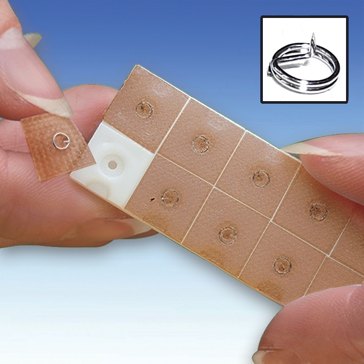 Ohr-Dauernadeln ratiomed 0,25 x 1,0 (10 x 10 Stck.)